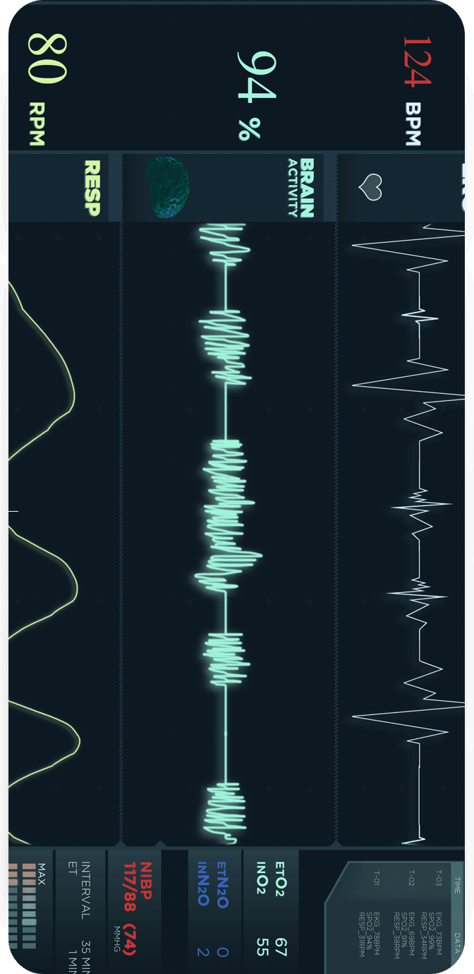 electrocardiogram2